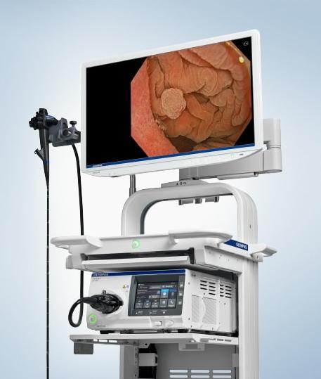 Endoscopy